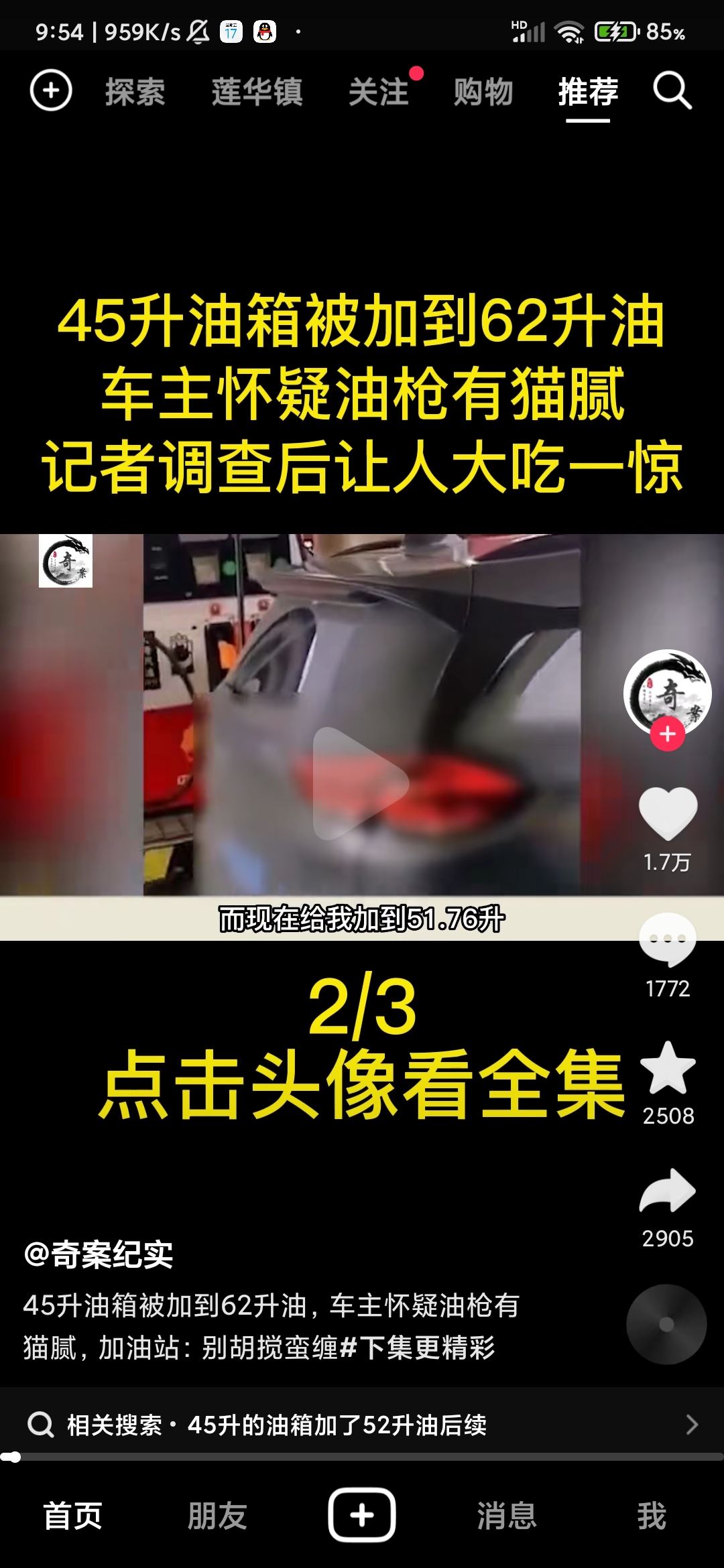 抖音頭像上快進按鈕怎么設置？