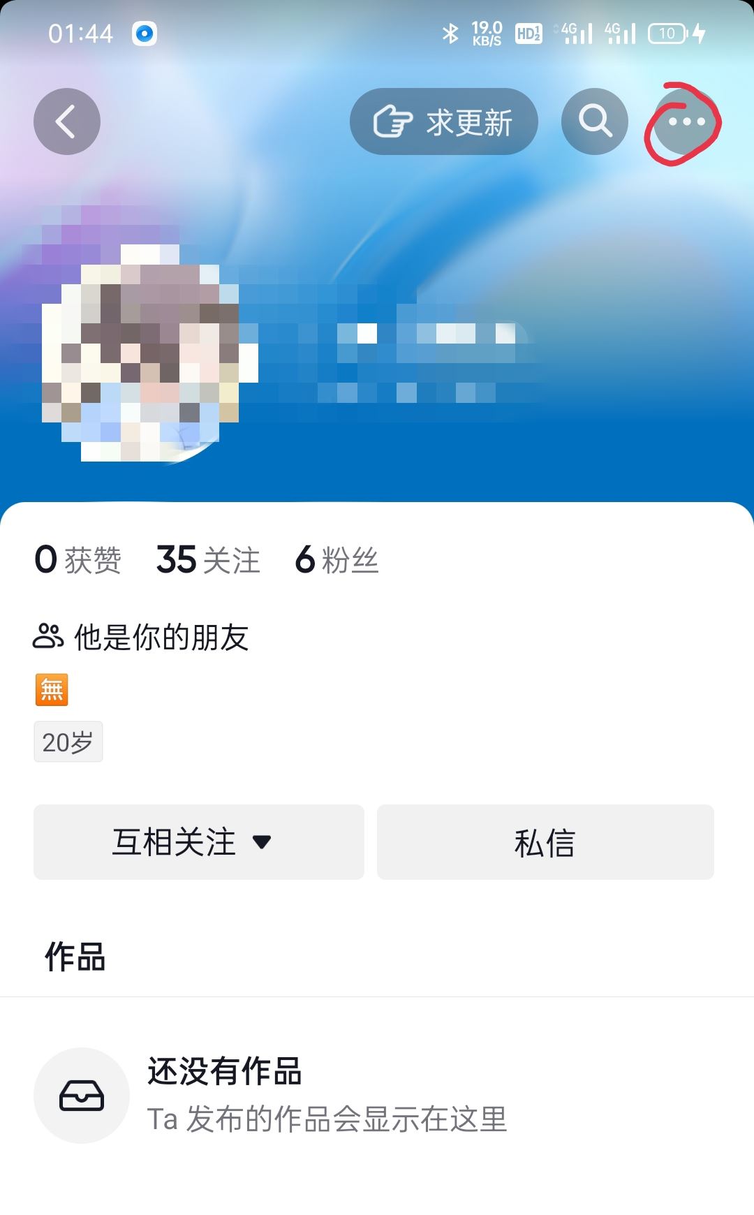 怎么移除抖音上面的朋友，對(duì)方會(huì)知道嗎？